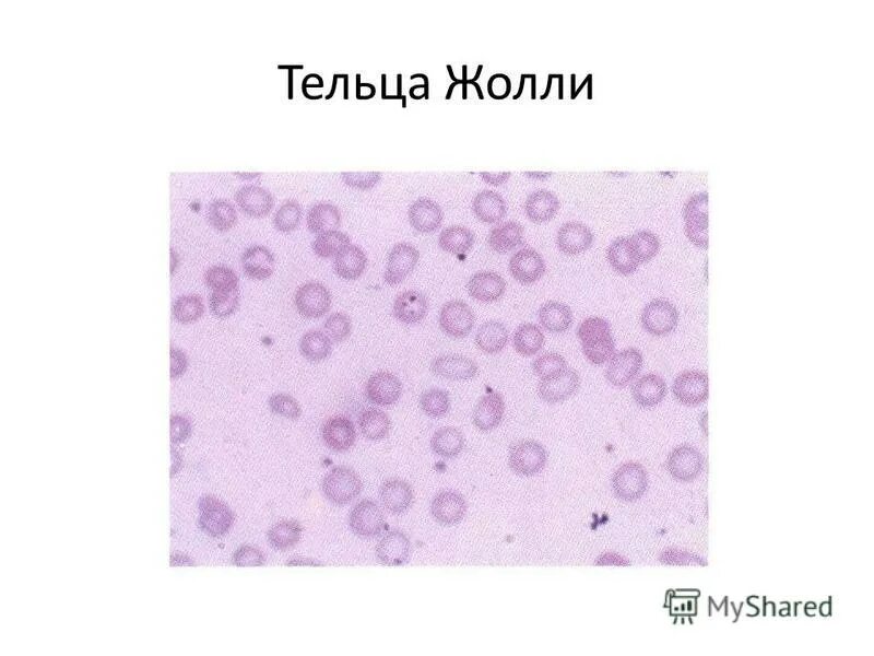 тельца жолли и кебота