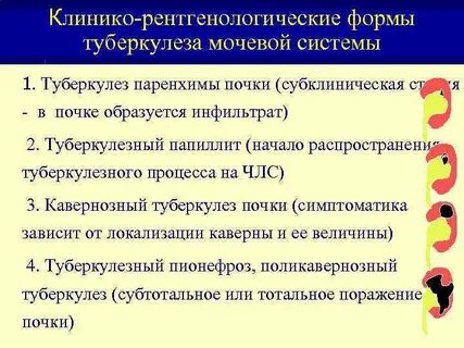 Туберкулезный папиллит