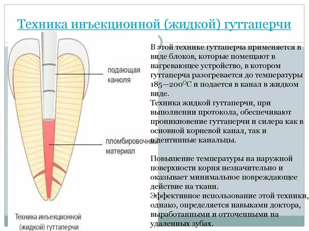 Термопластифицированной гуттаперчей. Пломбирование жидкой гуттаперчей. Техника инъекционной гуттаперчи. Гуттаперча для пломбирования корневых каналов. Гуттаперч вый опрометч вость