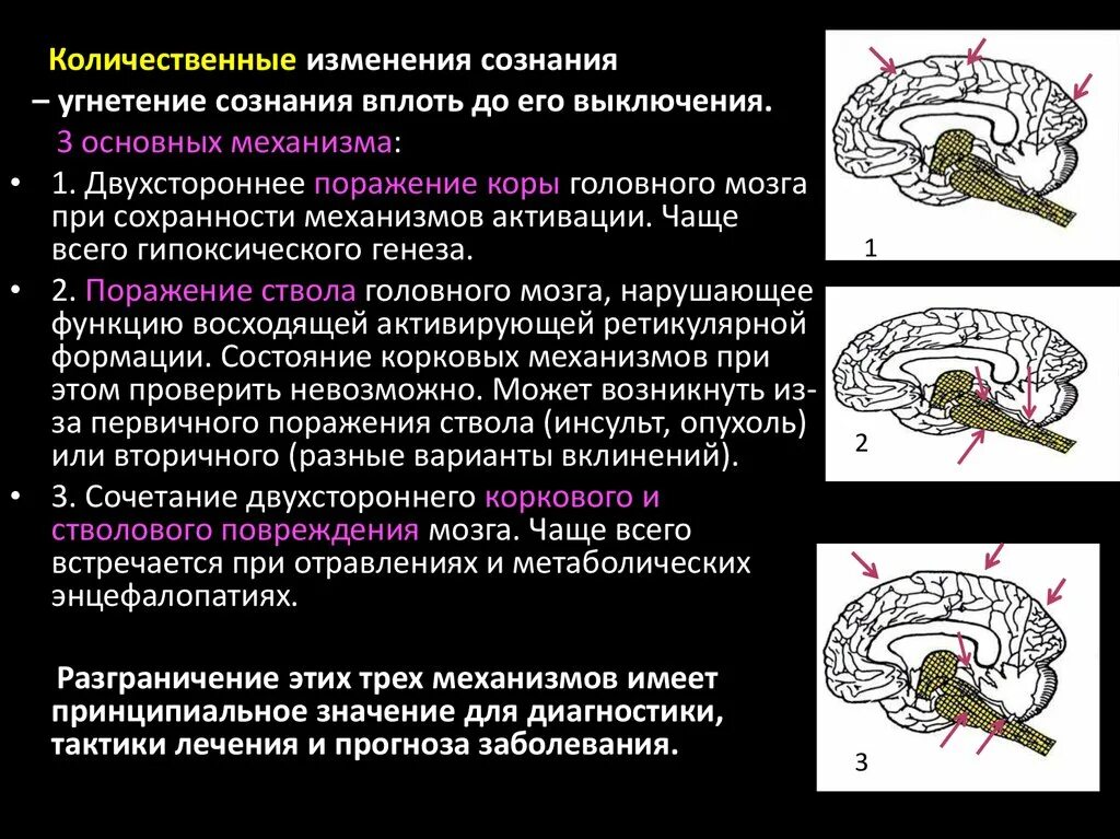 Энцефалопатия мозга последствия. Метаболическая энцефалопатия. Гипертоническая ангиоэнцефалопати. Поражение мозга при энцефалопатия. Метаболические изменения головного мозга.