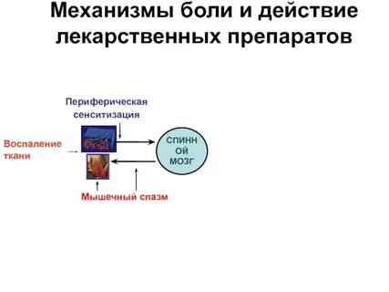 Механизмы боли
