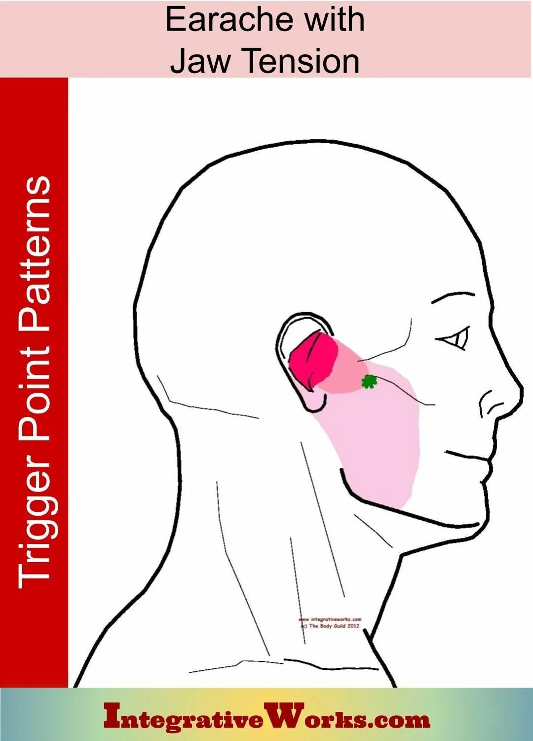 Точки шум в ушах. Боль в ухе триггерные точки. Триггерные точки от шума в ушах.