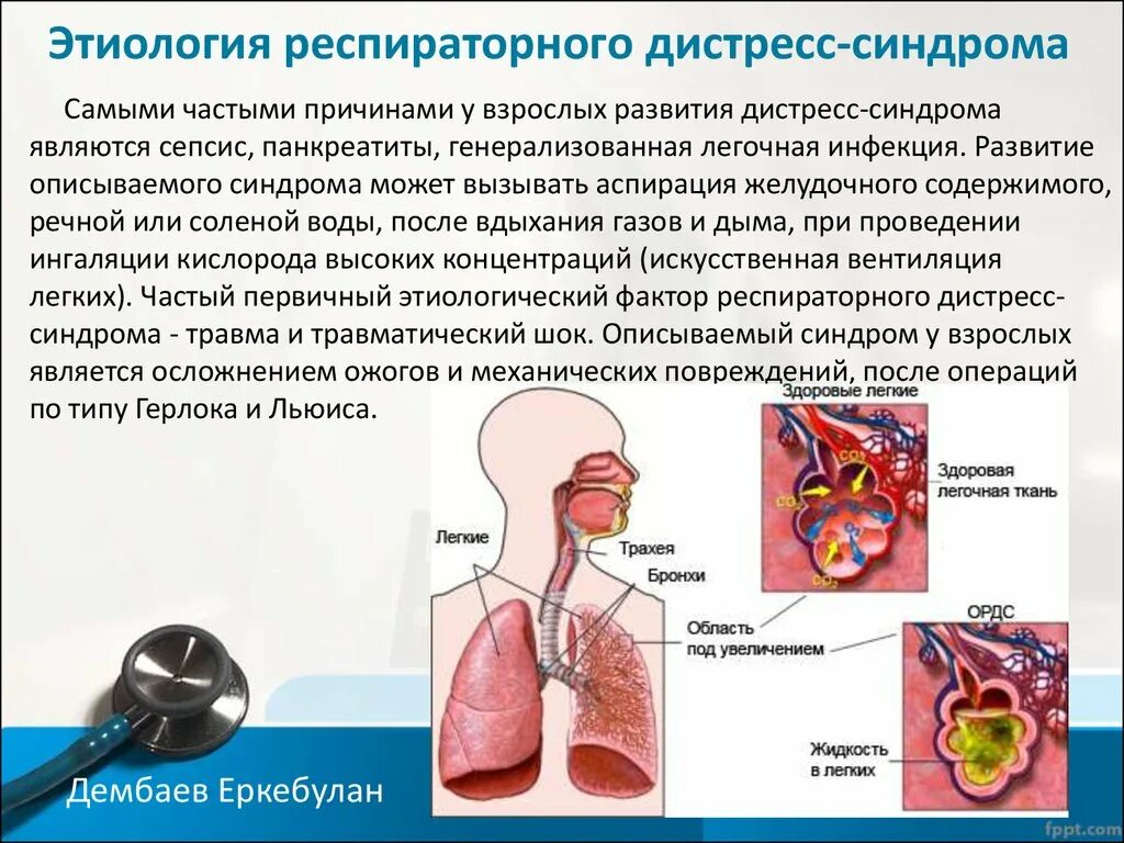 Синдром р д. Симптомы трисомии по х хромосоме. Острый респираторный дистресс-синдром осложнения. Ранний детский аутизм (рда). Синдром р д.