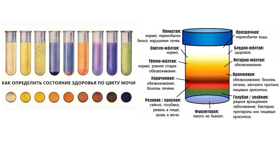Цвет нормальных вод. Окрас мочи при печени болезни. Темная моча при поражении печени. Какого цвета моча при болезни печени. Какого цвета моча при заболевании почек при беременности.