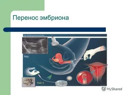 Общее в зародышах