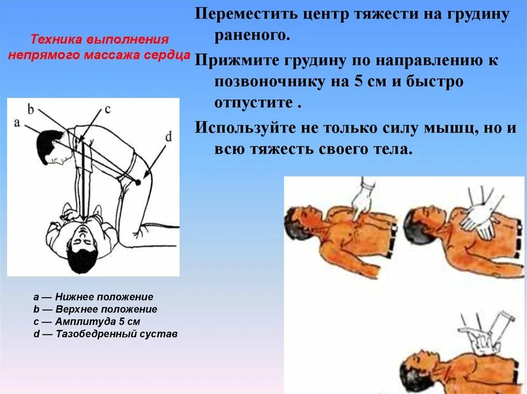 Проведение непрямого массажа сердца. Непрямой массаж сердца техника выполнения. Техника проведения непрямого массажа сердца. Методика выполнения непрямого массажа сердца. Как проводится непрямой массаж сердца