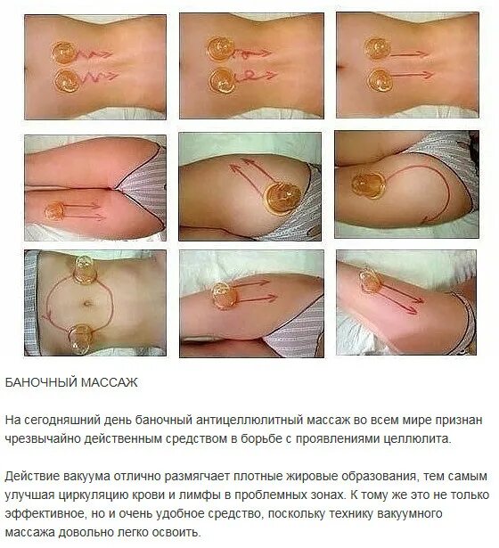 Вакуумный массаж схема антицеллюлитный. Антицеллюлитный массаж банками вакуумными схема. Баночный антицеллюлитный массаж схема. Схема баночного антицеллюлитного массажа. Схема баночного массажа живота и боков.