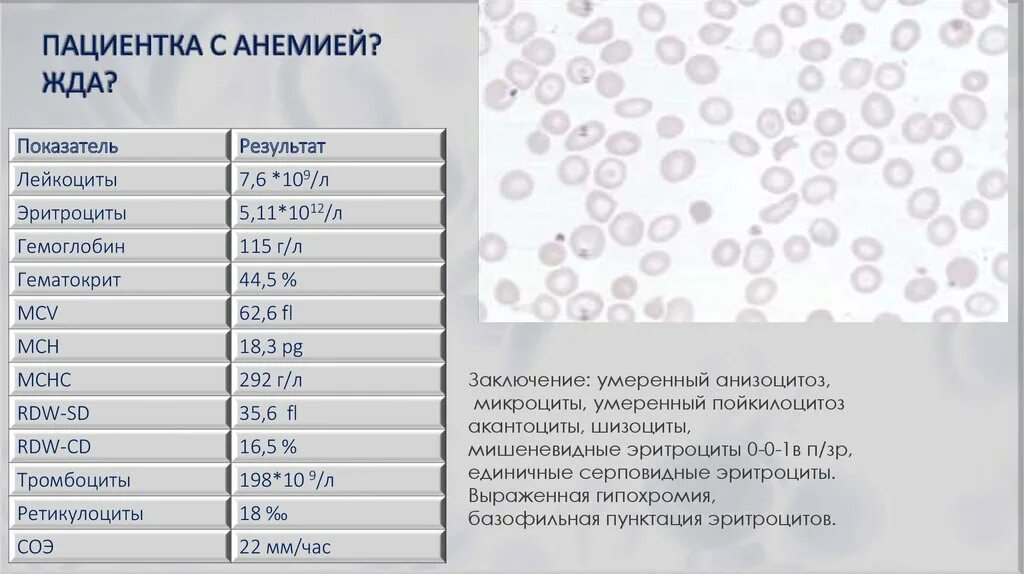 Микроциты повышены. Микроциты в крови норма. Шизоциты в крови норма. Микроциты в общем анализе крови.