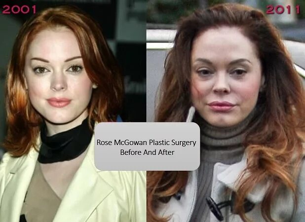 Роуз макгоуэн после. Роуз макгоуэн авария. Роуз макгоуэн до и после аварии. Роуз макгоуэн после. Роуз макгоуэн до аварии.