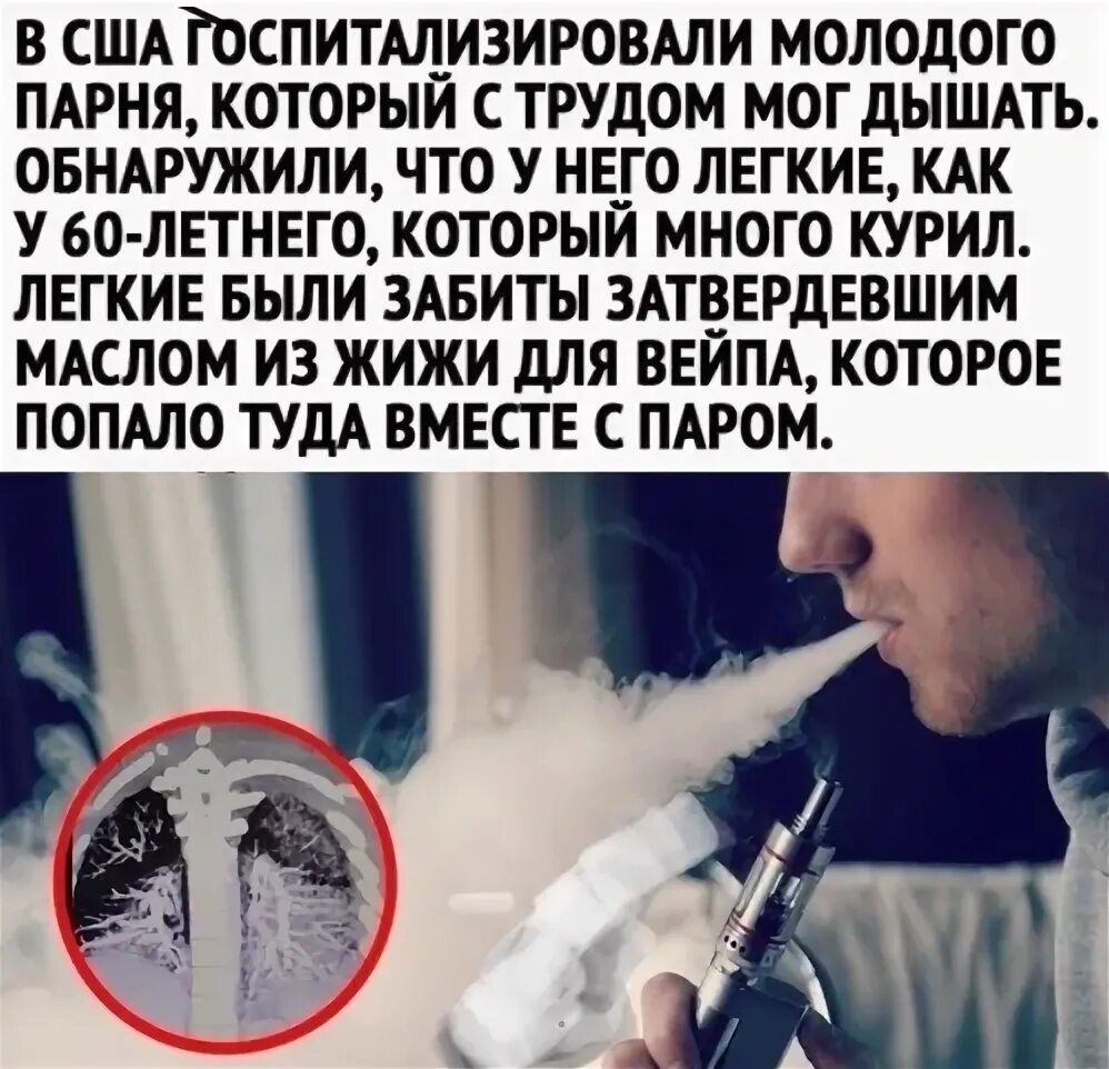 Как избавиться от парения