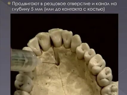 Резцовый канал на латыни