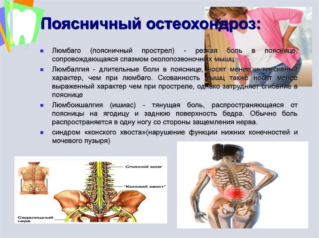 Проявления поясничного остеохондроза. Поясничный остеохондроз симптомы. Симптомы при поясничном остеохондрозе. Клинические проявления поясничного остеохондроза.