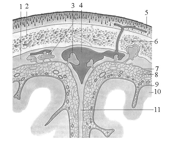 Головной мозг покрыт оболочками. Поперечный срез оболочек головного мозга. Пахионовы грануляции анатомия. Оболочки мозга анатомия. Оболочки головного мозга эмиссарная Вена.