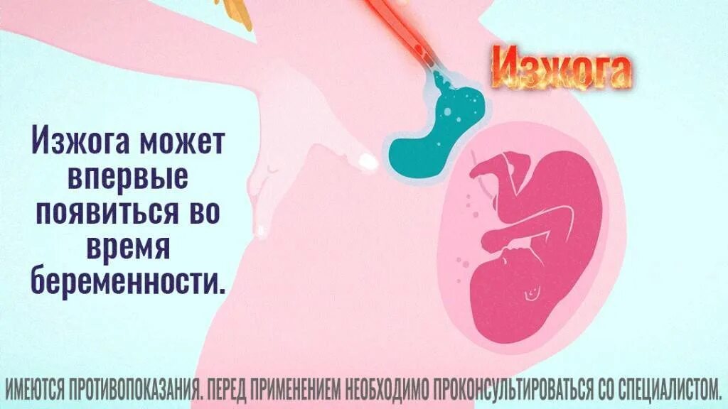 Изжога во 2 триместре. Беременность изжога. При изжоге при беременности. Изжога при беременности на ранних сроках. Изжога у беременной на раннем сроке.