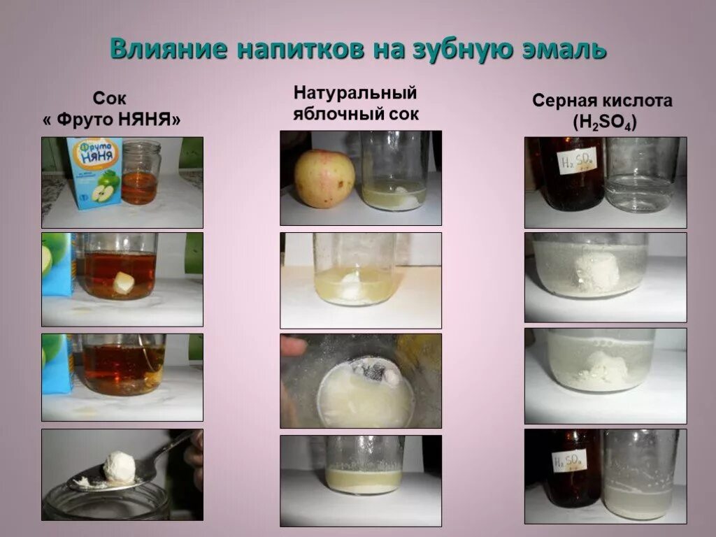 Серная кислота влияние. Влияние напитков на зубную эмаль. влияние напитков на зубную эмаль опыт. влияние газированных напитков на зубную эмаль.