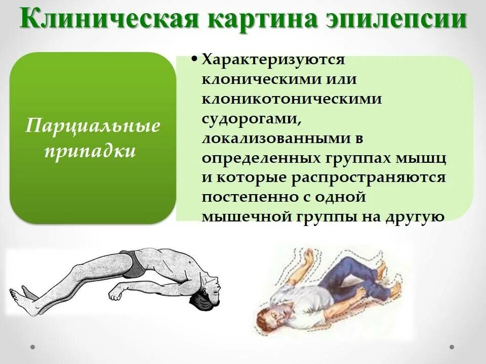 Панические судороги
