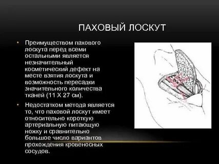 Лоскут это