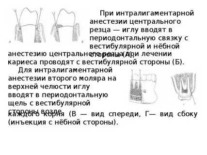 Анестезия зуба не проходит