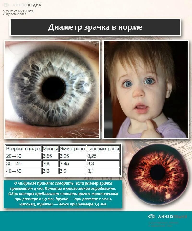 Глаз больше нормы