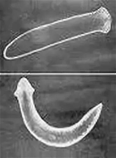 Гельминты у кошек черви. Планария дугезия. Плоские глисты у кошек. Плоские глисты у кошек. Кошачьи глисты анкилостома.