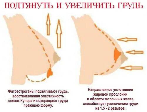 Как Можно Сделать Грудь Больше