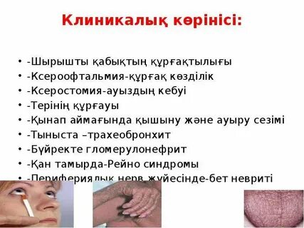 Лена Катина жалаңаш порно