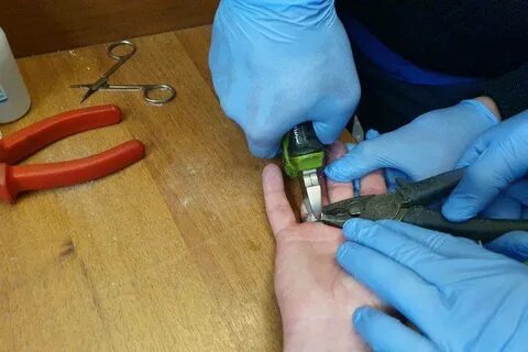 Как снять кольцо если не снимается