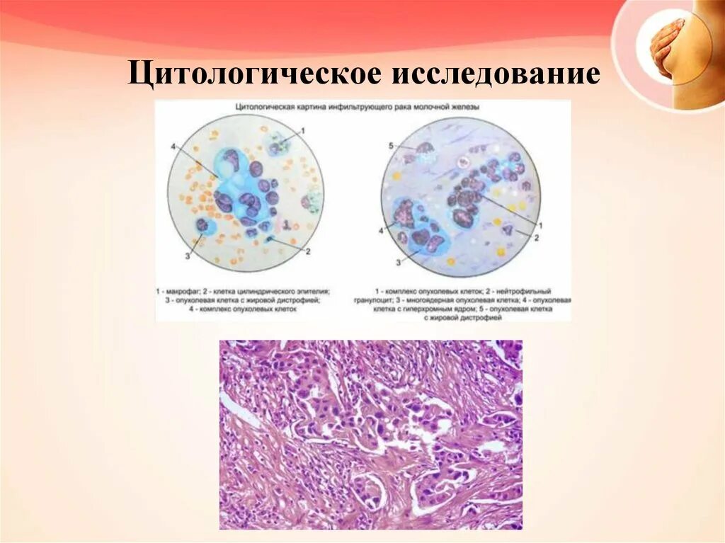 Цитологические и гистологические исследования. Цитологический метод исследования. Цитологическое исследование это исследование на. Цитологическая лаборатория исследует. Цитологический метод в онкологии.