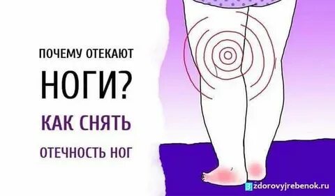Причина отека стоп ног у женщин