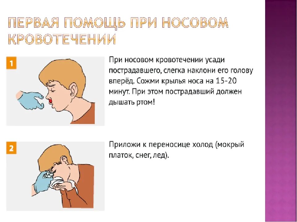Если идет кровь из носа что делать. ПМП при носовом кровотечении. ПМП при кровотечении из носа. Как оказать первую медицинскую помощь при кровотечении из носа. При носовом кровотечении больной должен лежать.