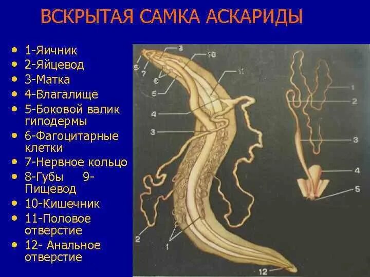 Аскарида Лошадиная строение. Внутреннее строение лошадиной аскариды. Половая система аскариды. Вскрытая самка аскариды.