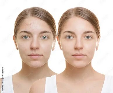 Face comparison