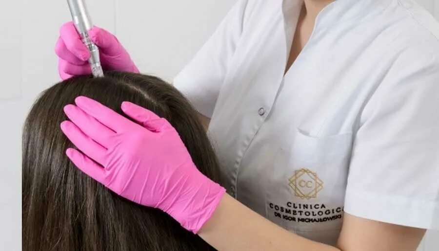дермапен мезотерапия волос. микронидлинг dermapen. микроигольчатая терапия дермапен. микронидлинг волосистой части головы. дермапен для волос.