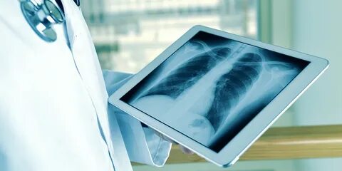 Urgent X-Ray Service Clear Lake Feature Image