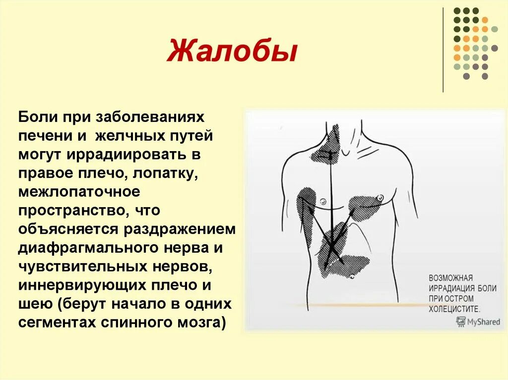 Печень боль в спине. Локализация боли печени. Локализация болей при заболеваниях печени. Боли при заболевании печени иррадиируют.