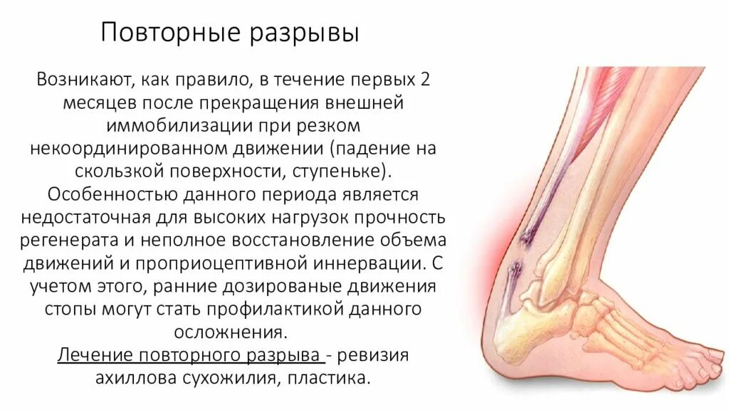 Сколько заживает сухожилие. Разрыв ахиллесового сухожилия симптомы. Симптоматика повреждения ахиллова сухожилия. Разрыв ахиллова сухожилия симптомы. Субтотальный разрыв ахиллова сухожилия.