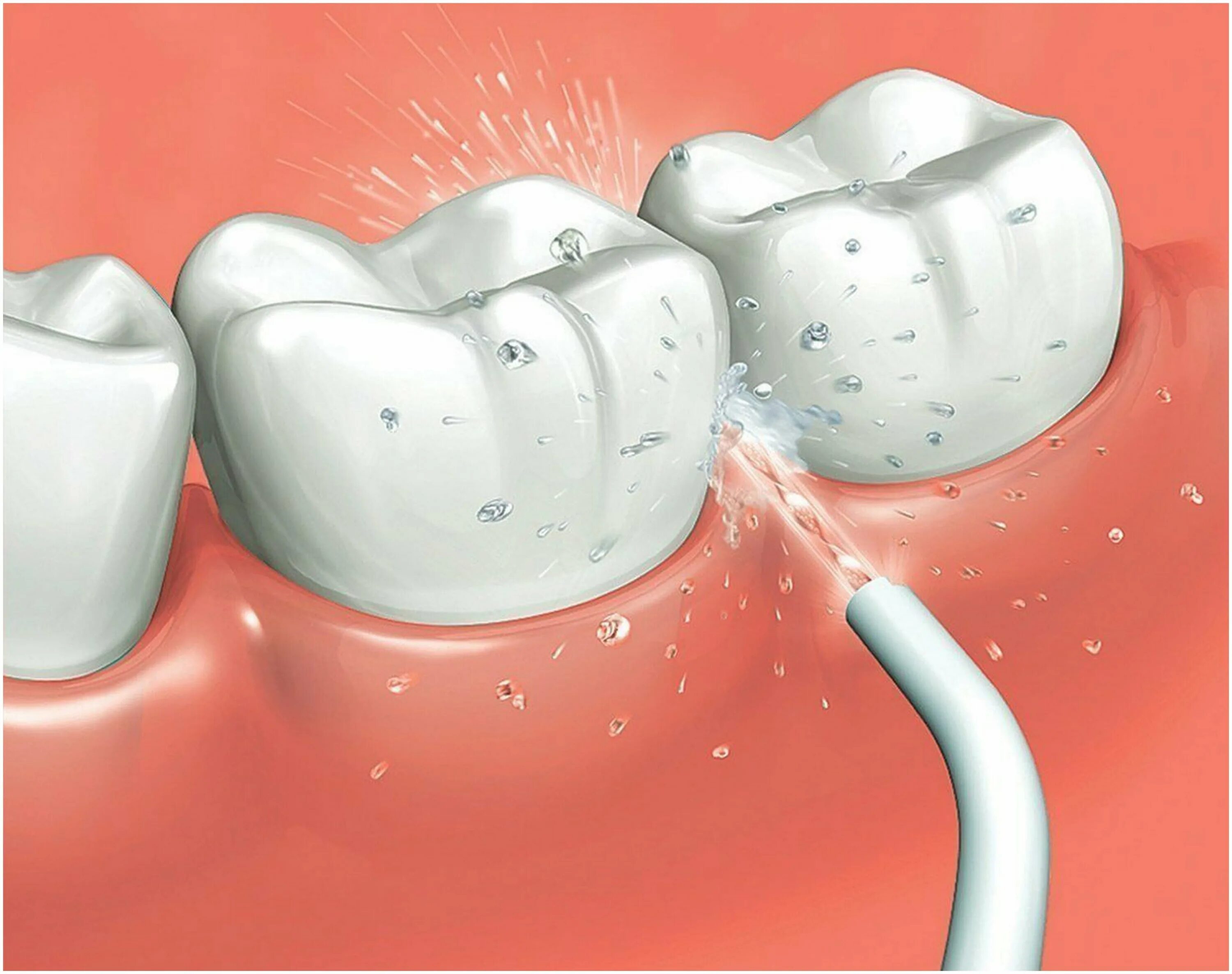 прибор для проф чистки зубов. стоматологический ирригатор для полости рта. ирригатор b. ирригатор для зубов waterdent. портативный ирригатор для очистки полости рта.