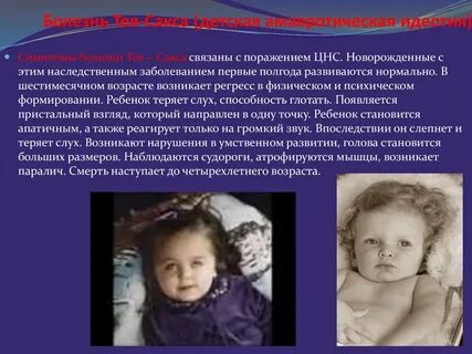 Тея сакса