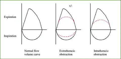 Volume curve