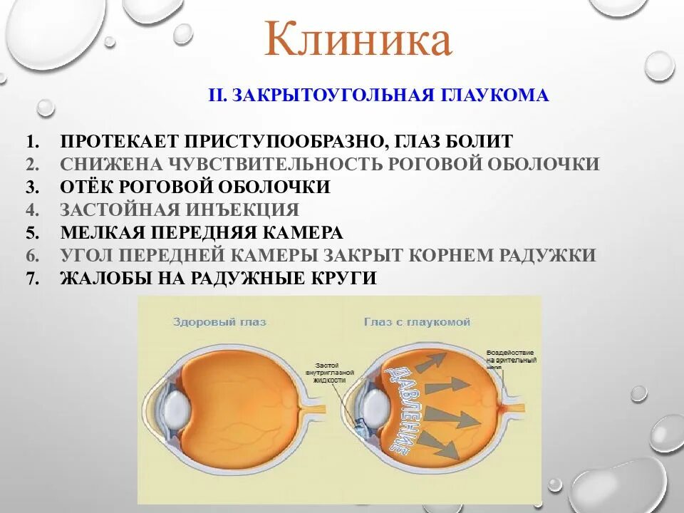 Что делать при глаукоме глаза. Открытоугольная глаукома профилактика. Первичная открытоугольная глаукома симптомы. Первичная закрытоугольная глаукома клиника. Закрытоугольная глаукома приступ.