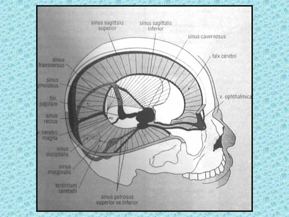Sinus sagittalis superior. Sinus sagittalis superior