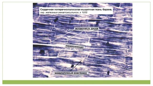 Поперечнополосатая мышечная ткань сердца. Поперечнополосатая мышца гистология. Поперечно полосатая сердечная ткань гистология. Поперечнополосатая Скелетная мышечная ткань гистология. Поперечнополосатая сердечная мышечная ткань препарат.