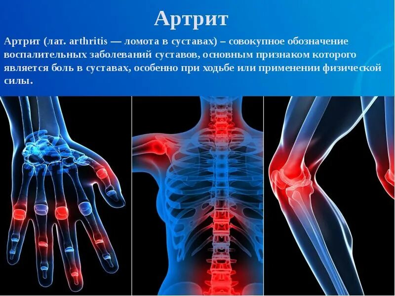 Заболевание опорно двигательный аппарат человека. Заболевания опорно-двигательного аппарата. Болезни опорно двигательной системы. Опорно двигательный аппарат. Хронические заболевания опорно-двигательного аппарата.