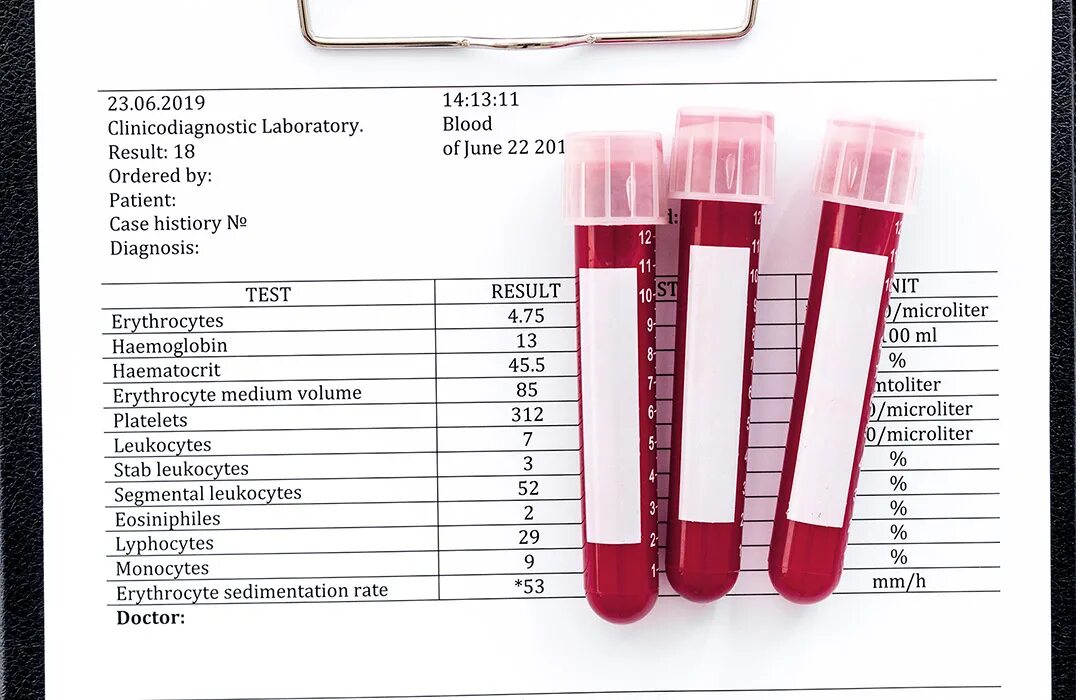 Домашний тест крови. Blood Test Results. Test Results.