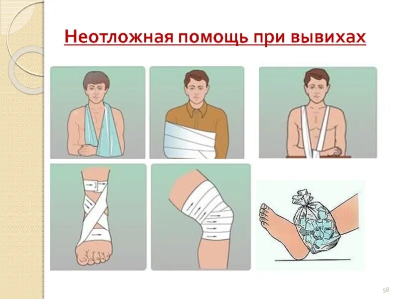 Оказание доврачебной помощи при вывихе. Алгоритм оказания 1 доврачебной помощи при вывихе. алгоритм оказания пмп при вывихе. оказание пмп при растяжении связок. последовательность первой помощи при вывихе.