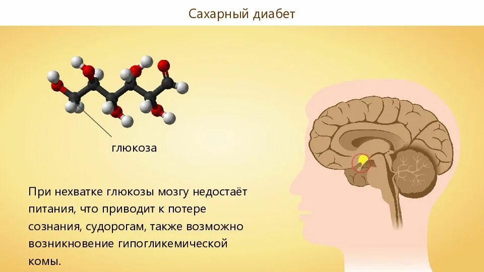 Глюкоза для мозга. Недостаток сахара. Глюкоза и головной мозг. Сахар для головного мозга.