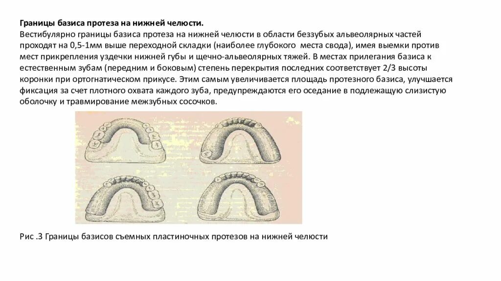 Границы пластиночного протеза. Граница базиса частичного съемного протеза на верхней челюсти. Границы базиса съемного протеза на верхней челюсти. Границы базиса на верхней и нижней челюсти. Границы базисов пластиночных протезов при дефектах зубных рядов..