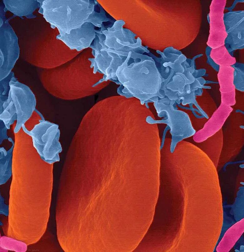 Пути заражения стрептококком фото. Ctg в си. Гонорея пути передачи инфекции. Заражение органов. Заражение органов.