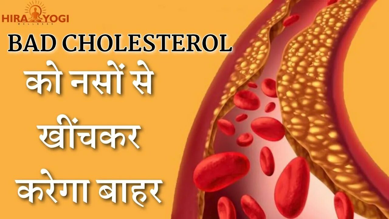 Cholesterol levels
