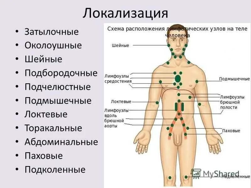 Периферические лимфатические узлы схема. Лимфоузлы паховые где находятся схема. Увеличены лимфоузлы расположение. Лимфоаденопатия (увеличение лимфатических узлов).. Лимфоузлы в паху воспаление причины лечение